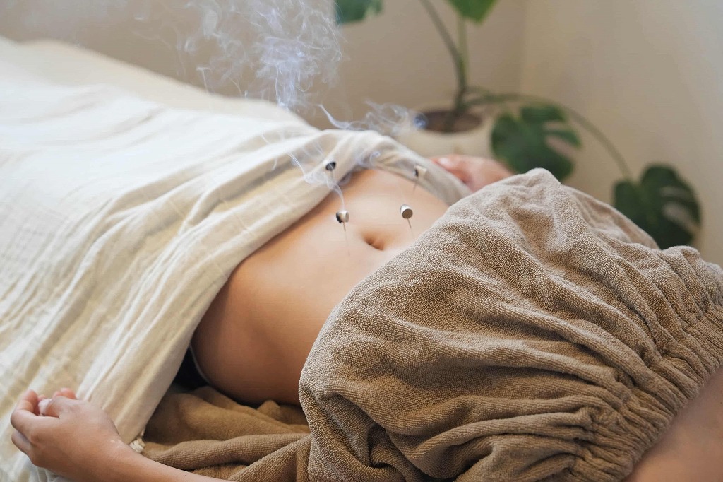 鍼をしているところ